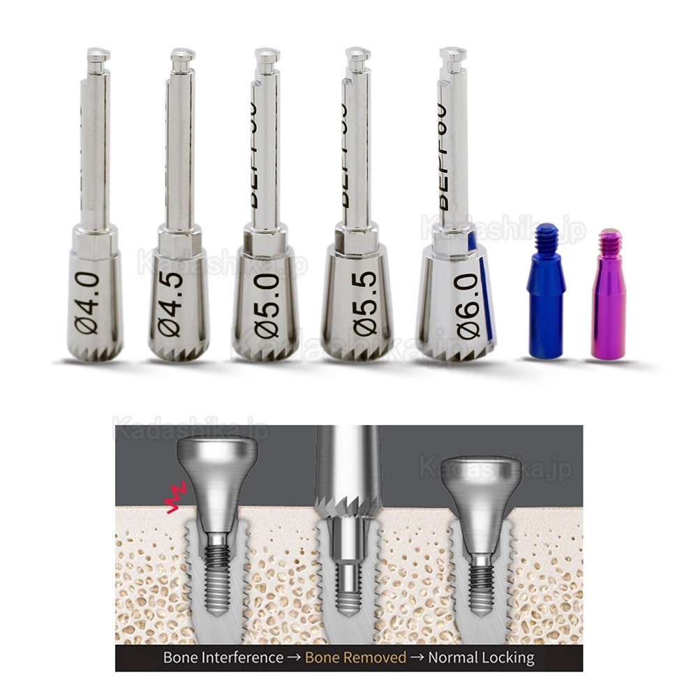 インプラント ET ボーンプロファイラー&ガイドスクリュー 4.0 4.5 5.0 5.5 6.0 (Hiossen OSSTEMスタイル) インプラント ET ボーンプロファイラー&ガイドスクリュー 4.0 4.5 5.0 5.5 6.0 (Hiossen OSSTEMスタイル)